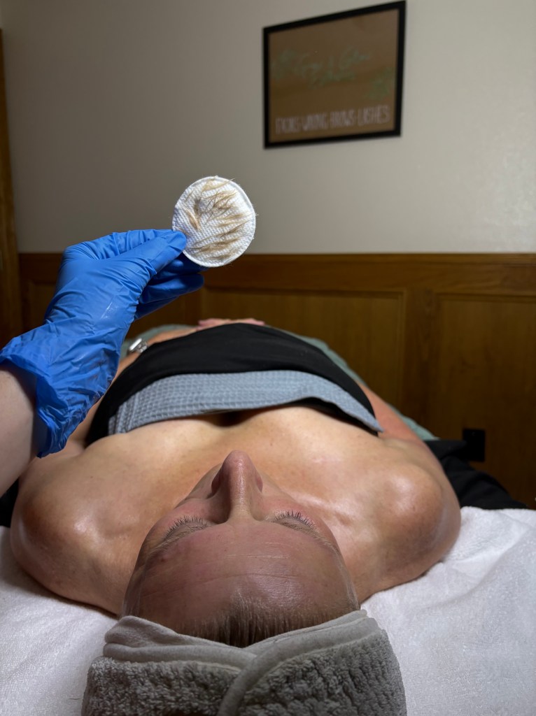 Close up of facial client post-dermaplane. Esthetician holding exfoliated skin for deep glow results. Surgical blade used to remove dead skin and peach fuzz. In a dermaplane service it includes a double cleanse, dermaplaning, and finishing products.